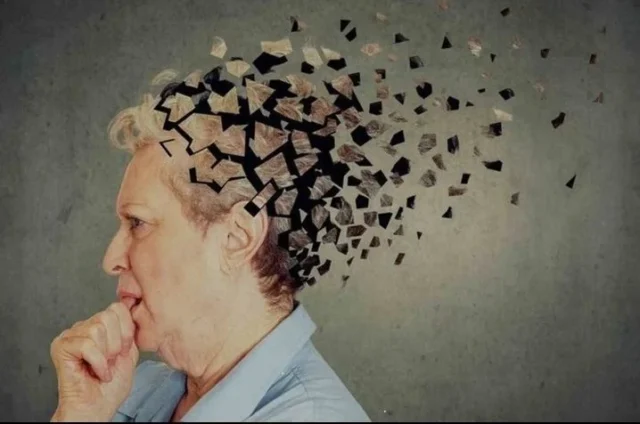 Studi Temukan Hubungan Antara Kolesterol Tinggi dan Risiko Penyakit Alzheimer